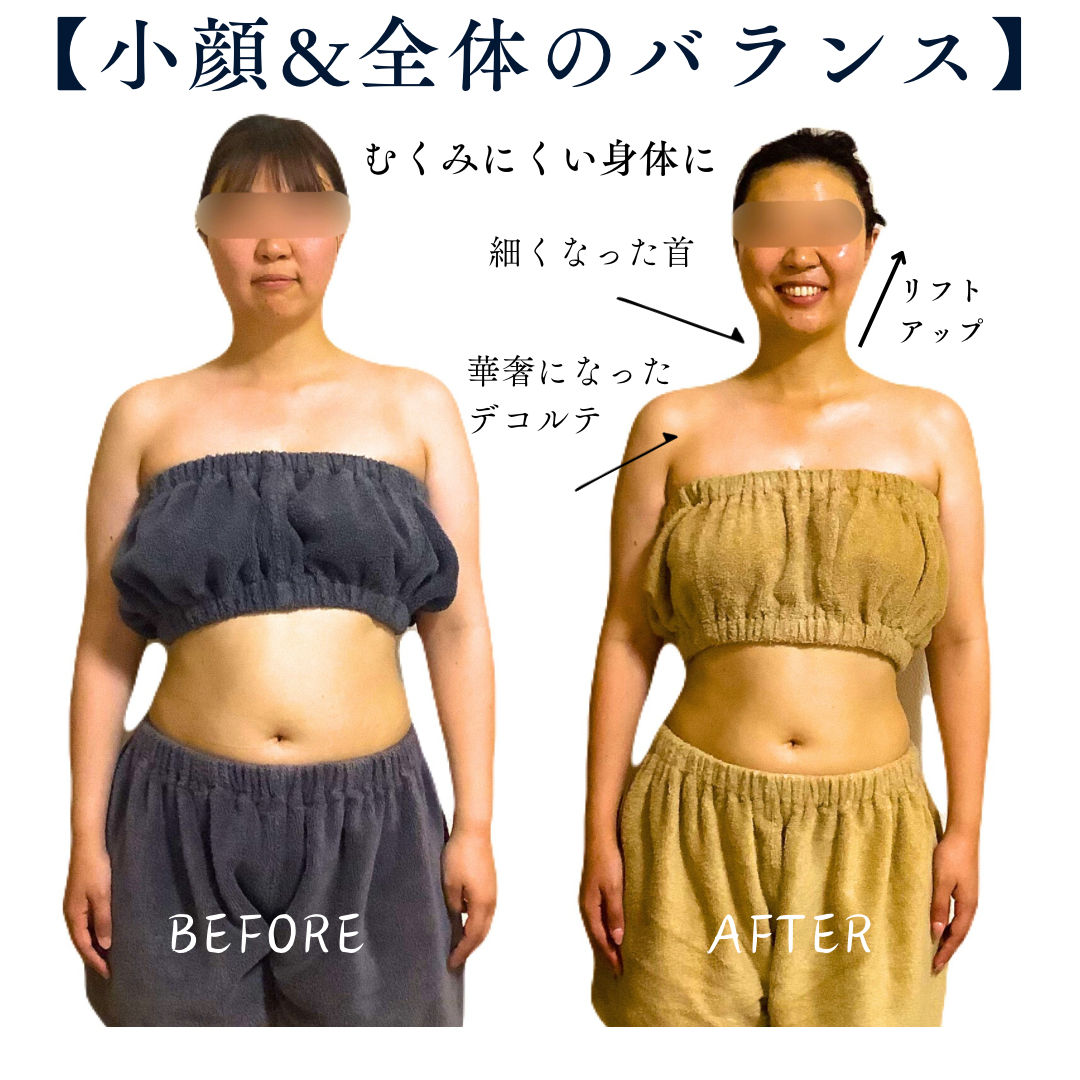 【花嫁準備☆写真映えする首・デコルテに】