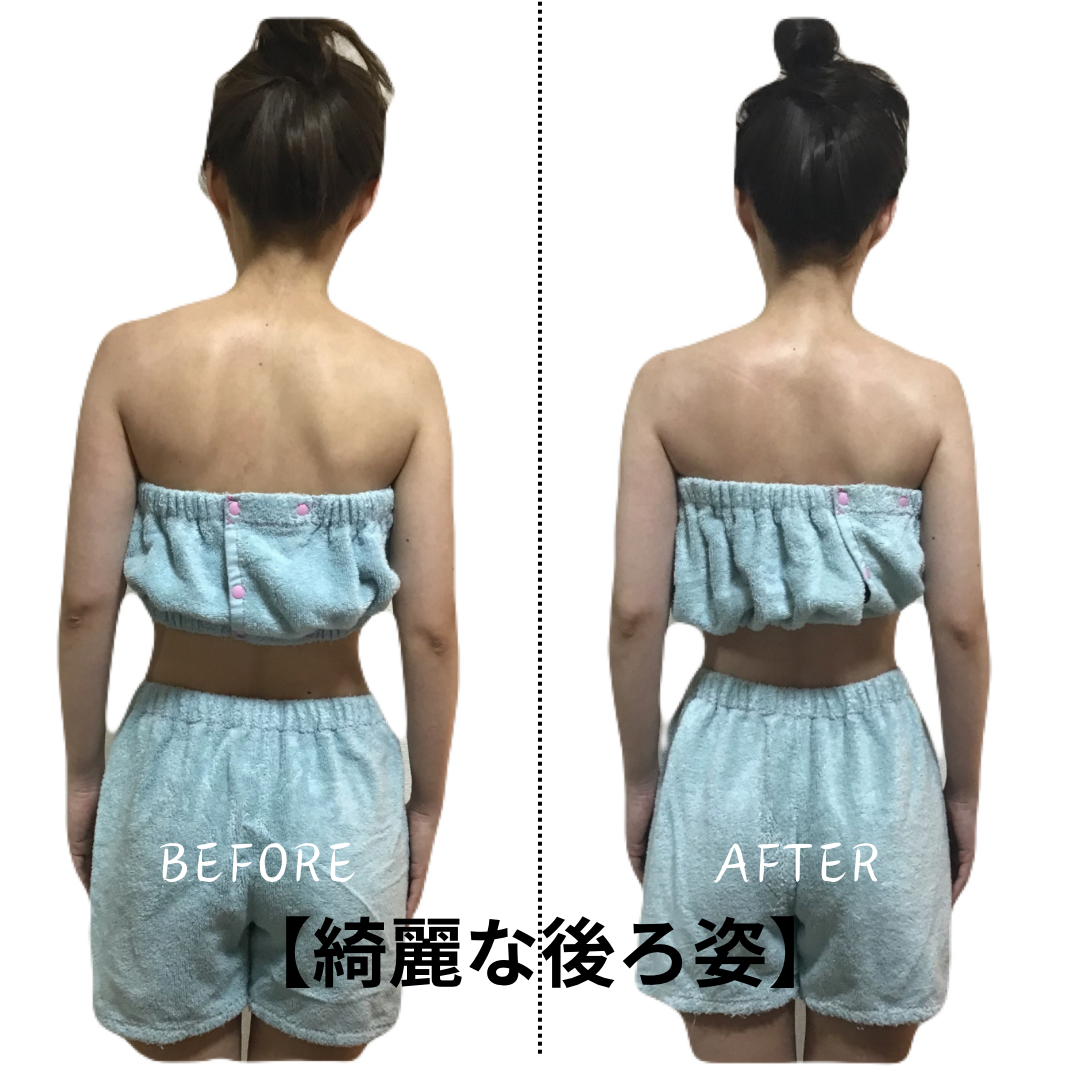 【後ろ姿の崩れは骨格の歪みが原因かもしれません】