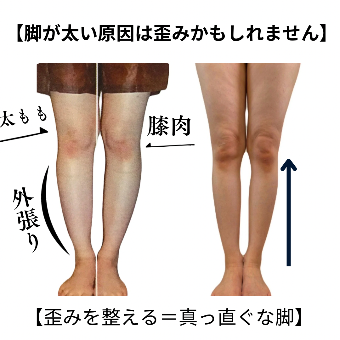 【脚が太い原因は脂肪じゃない？実は◯◯かもしれません】