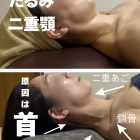 【たるみ、二十顎の原因は首だった！】