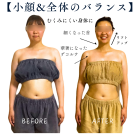 【花嫁準備☆写真映えする首・デコルテに】