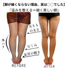 脚が太く見える原因は歪み？整えるとここまで変わります